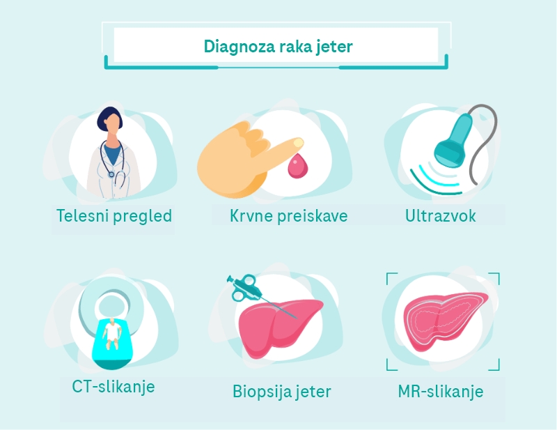 Za postavitev diagnoze raka jeter so potrebne različne preiskave (ultrazvok, biopsija ...).