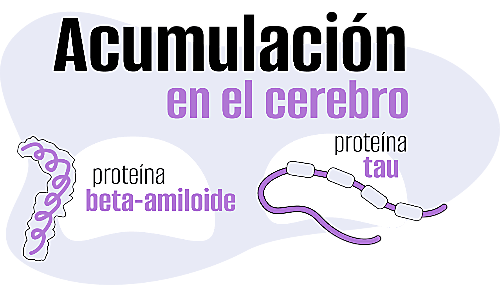 Factores de riesgo que aumentan la probabilidad de padecer alzheimer