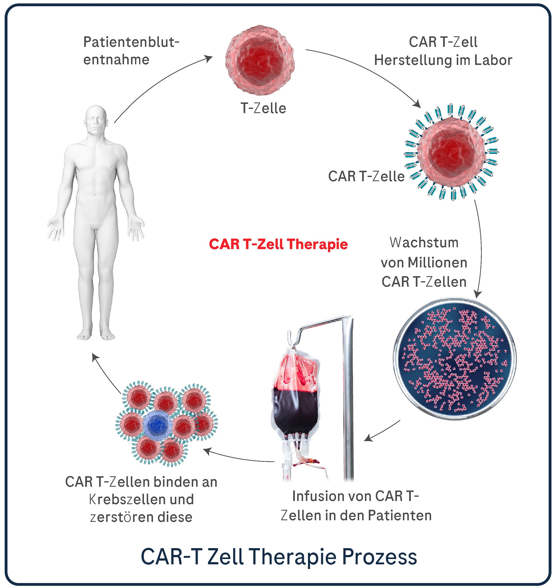 DLBCL_Infographic_AUSTRIA-zukunftdermedizin_LC_02.png