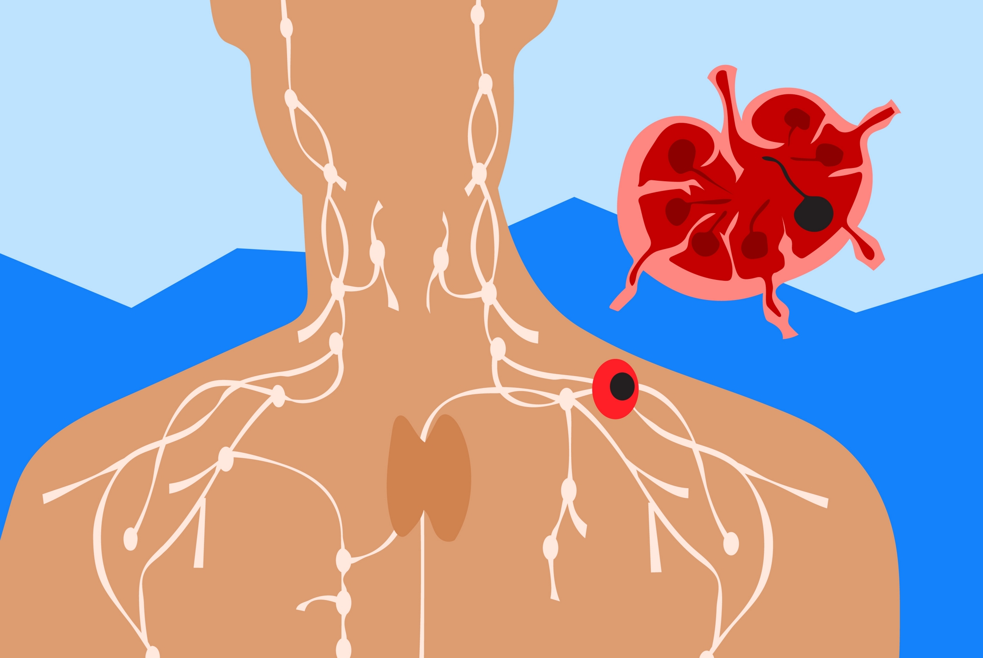 1071867_20_CCAV_Other_Image_LC_Roche Contigo Caribe-Hematologia Padecimientos Imagenes Varias_Gabriela Pico