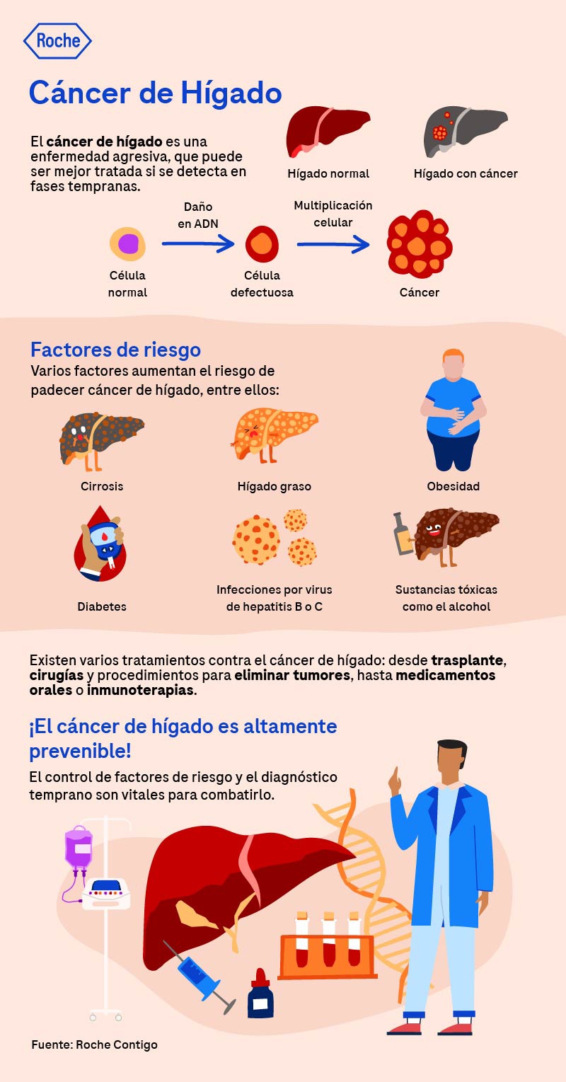 Cáncer de Hígado