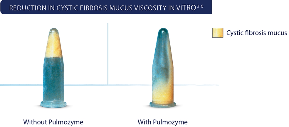 reduction in cystic fibrosis