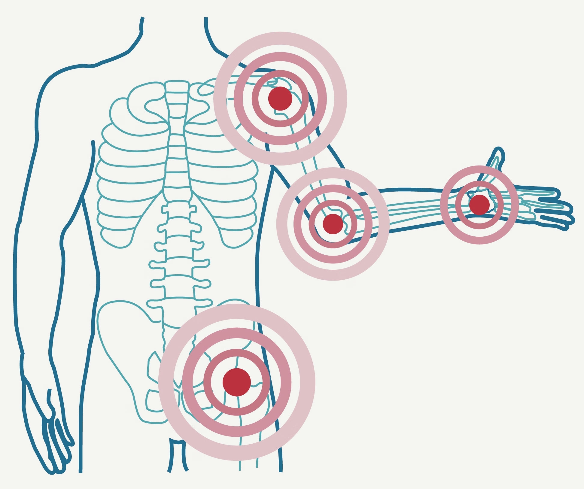 rheumatologie-img3.png