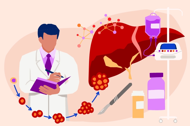 ¿Qué es el cáncer de hígado?