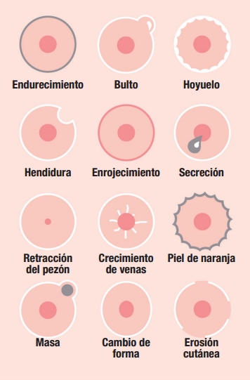 Síntomas del Cáncer de Mama