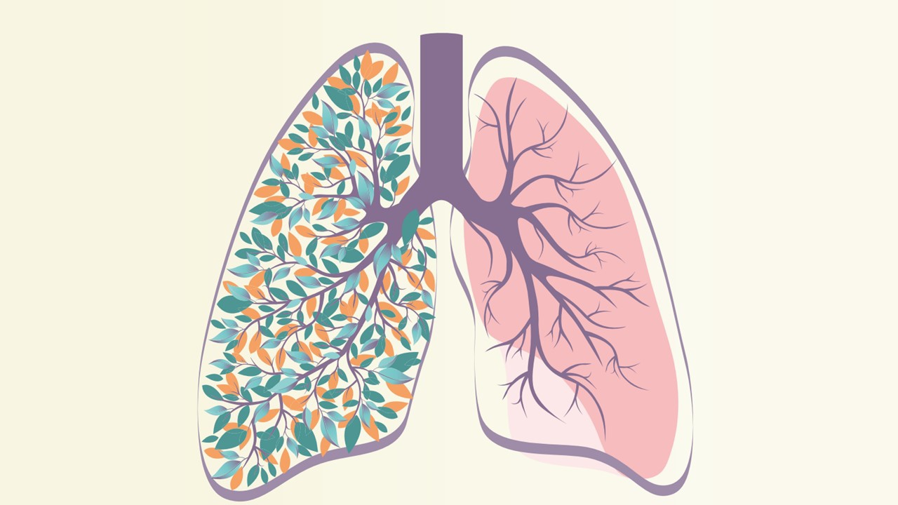 dzive ar plausu vezi