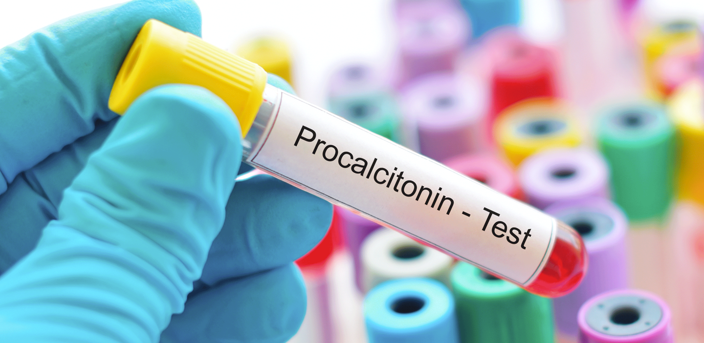 Procalcitonin: Lessons Learned and Ideas for the Future