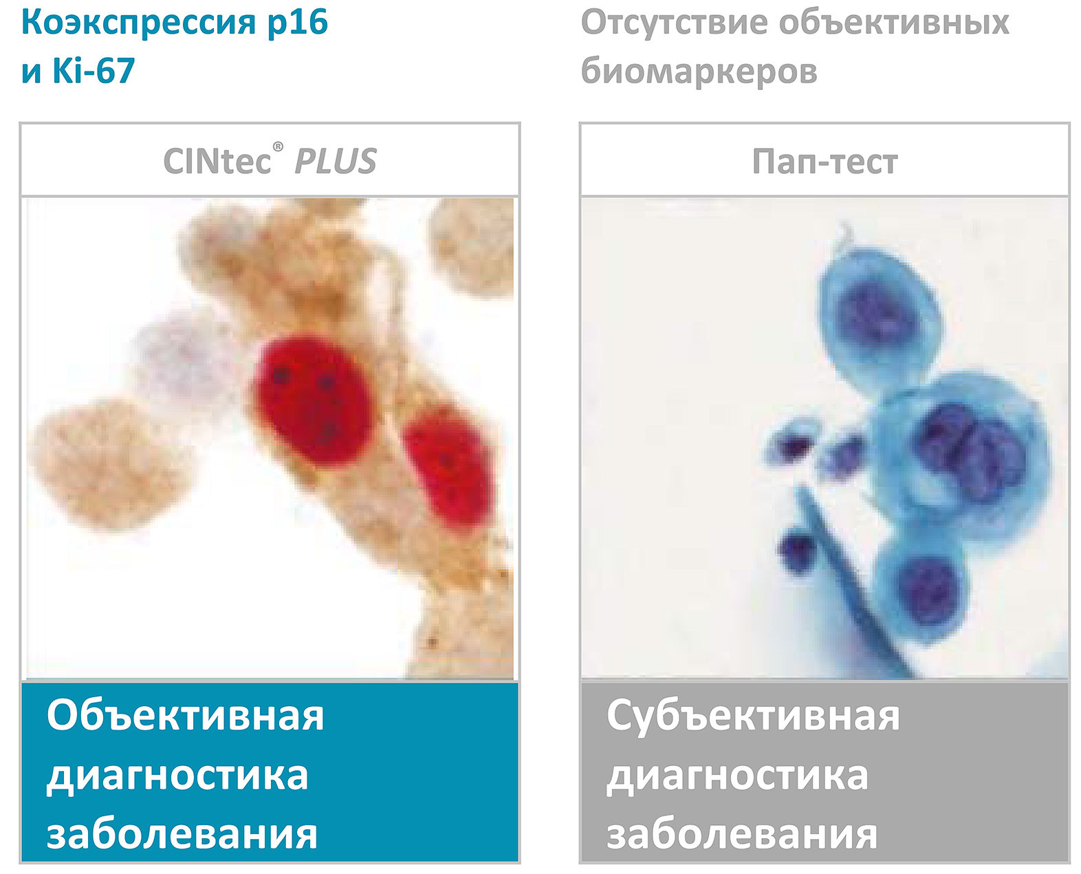 Тест CINtec® PLUS Cytology