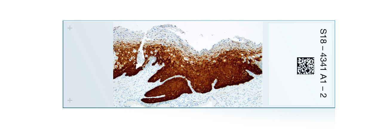 hig1003ページ‼️ CINtec® Histology