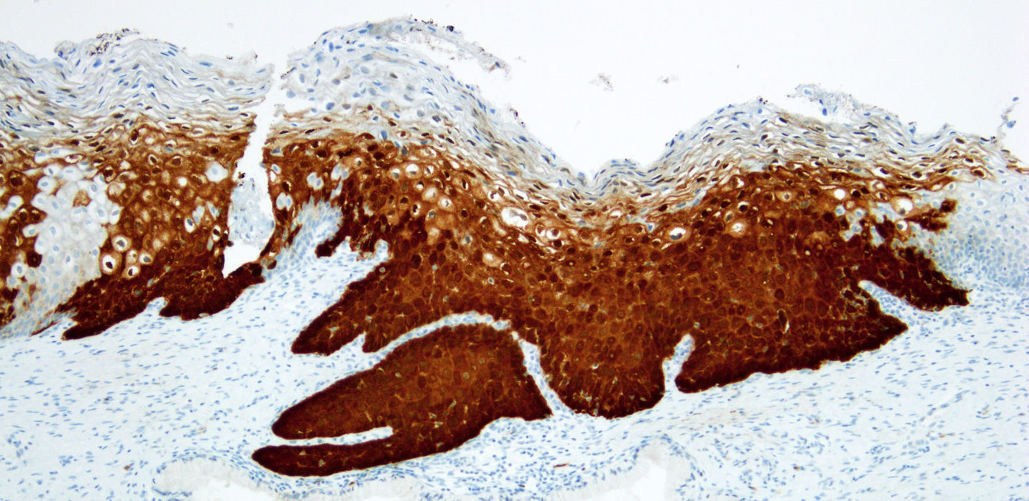 CINtec Histology boyaması