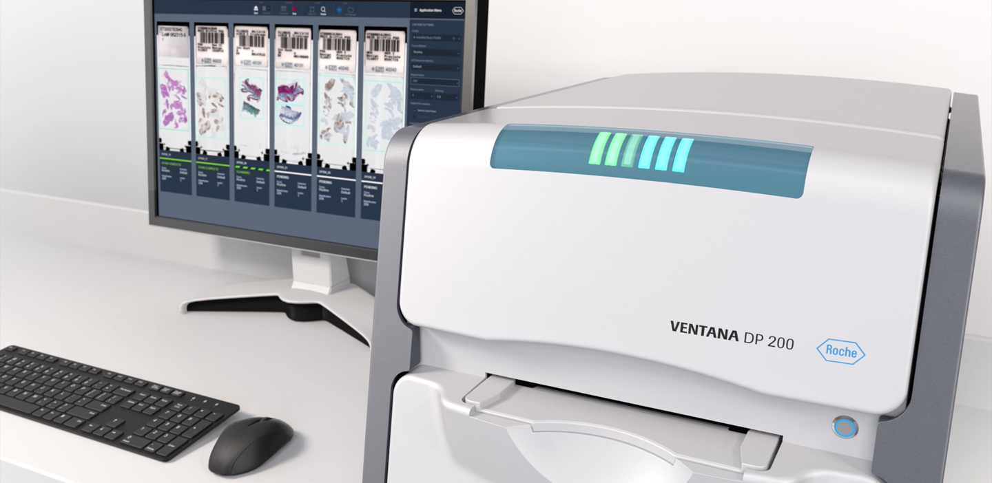 Roche receives FDA clearance for primary diagnosis on its digital pathology solution