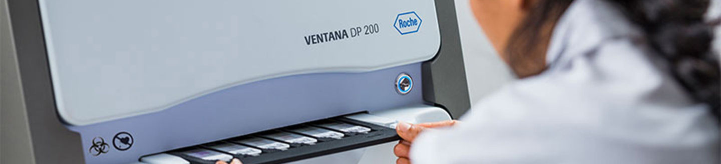 Roche lanza el digitalizador de portaobjetos VENTANA DP 200 para patología digital