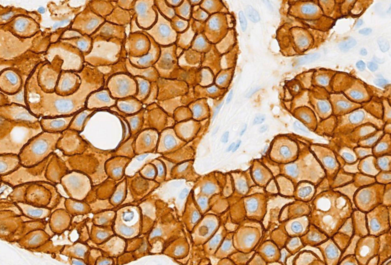 MUM1 (EP190) Rabbit Monoclonal Primary Antibody