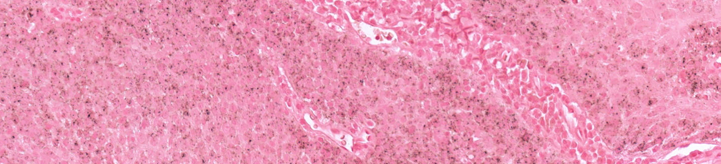 Roche HPV mRNA Probes