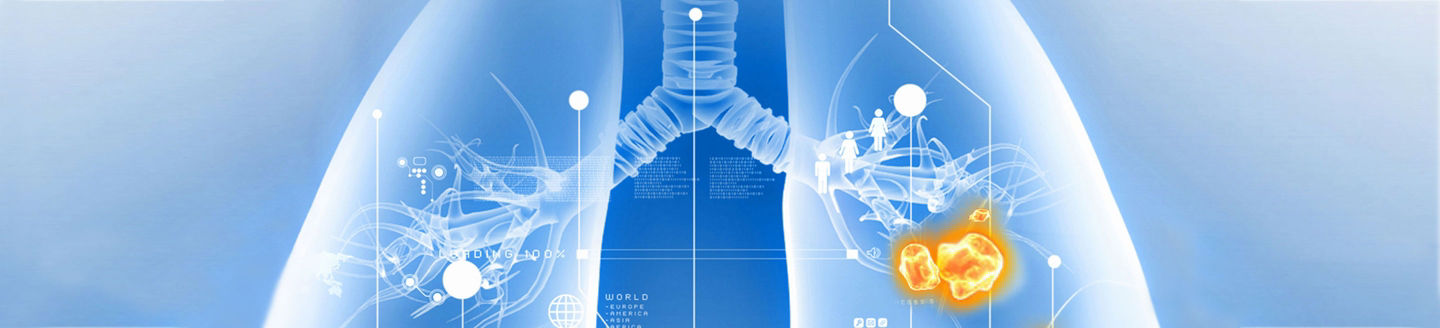 Lung cancer illustration