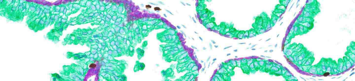 Discovery Green HRP IHC Stain