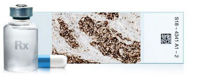 VENTANA® PD-L1 (SP142) Assay