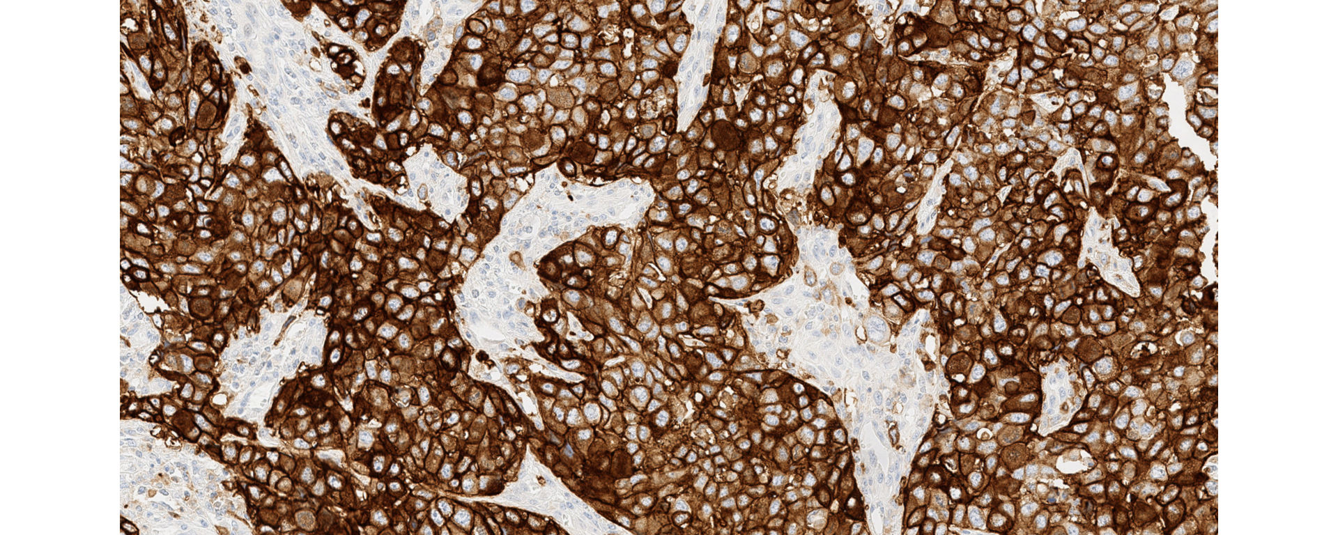 VENTANA PD-L1 SP263 Assay UC