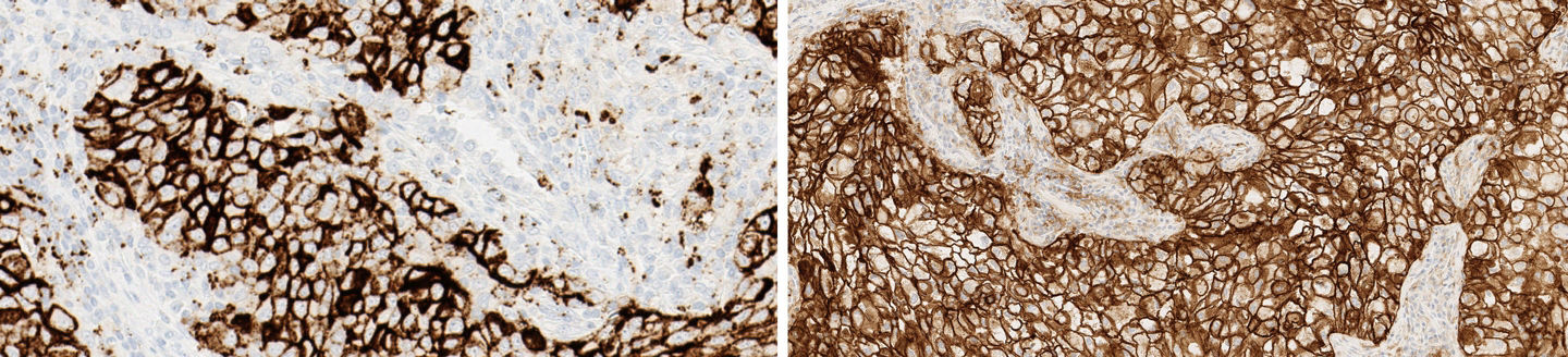 pdl1-stain