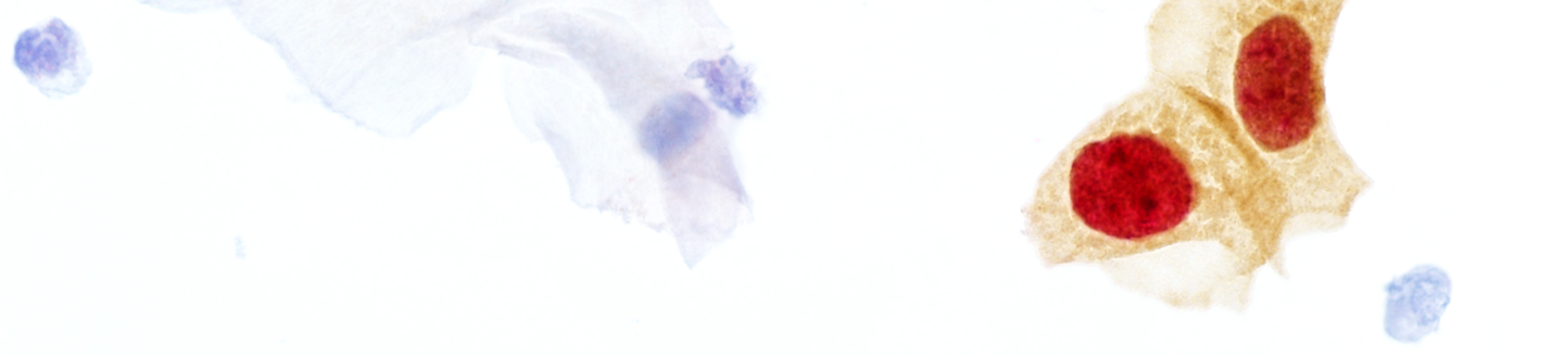CINtech Plus Cytology stain