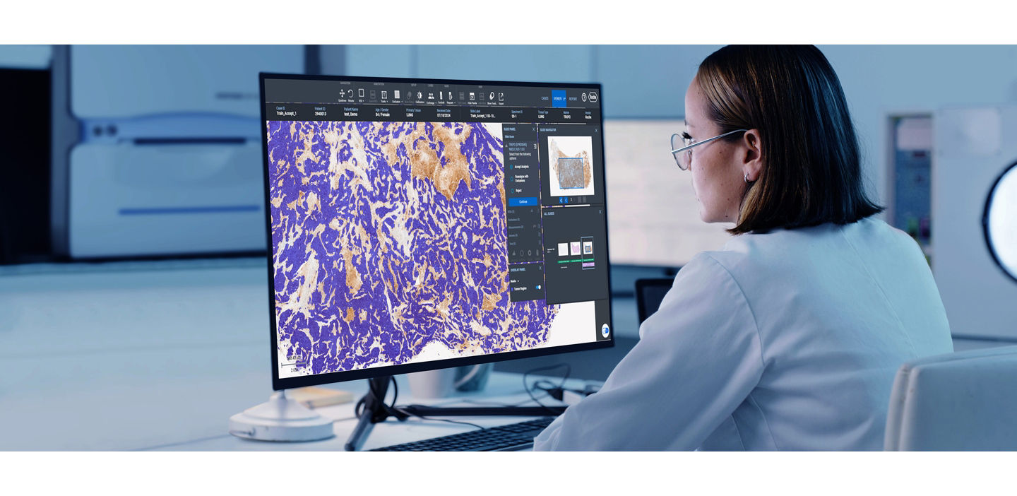 lab tech viewing a trop2 algo autodetection overlay