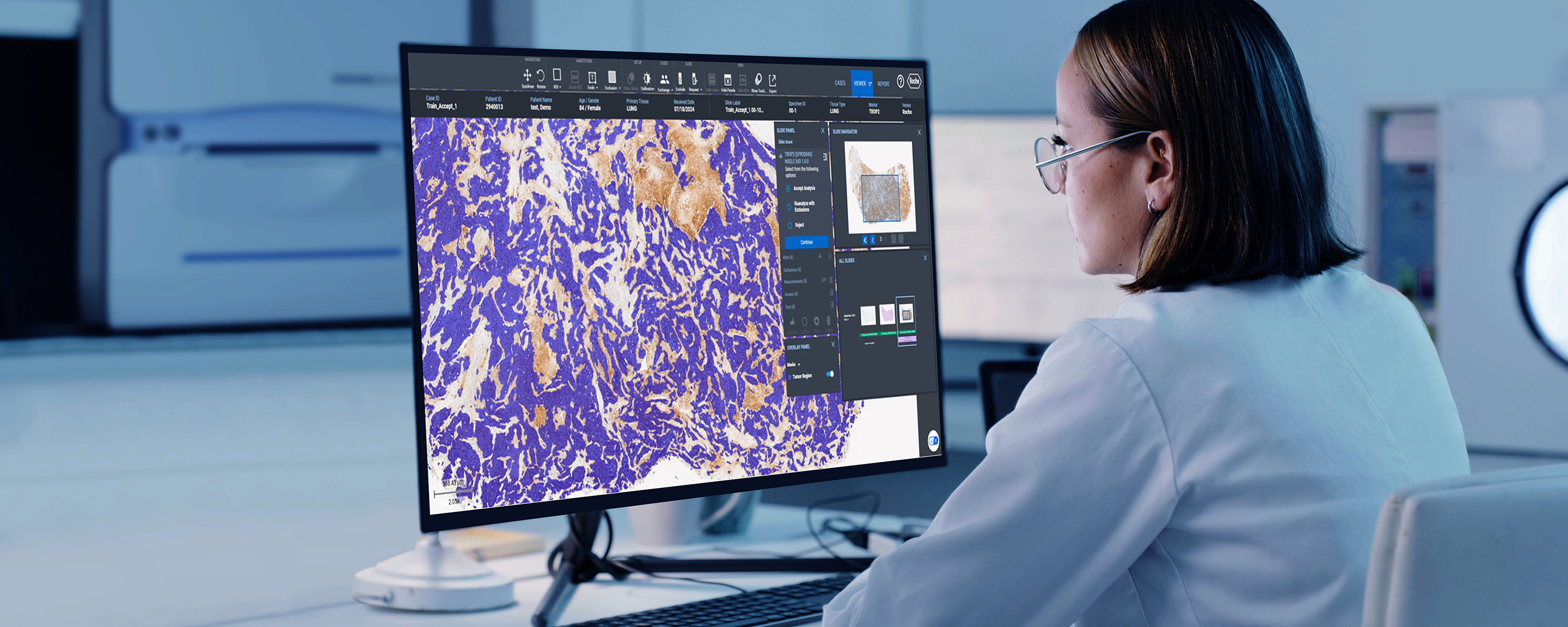 What is the future for tissue diagnostics in oncology?