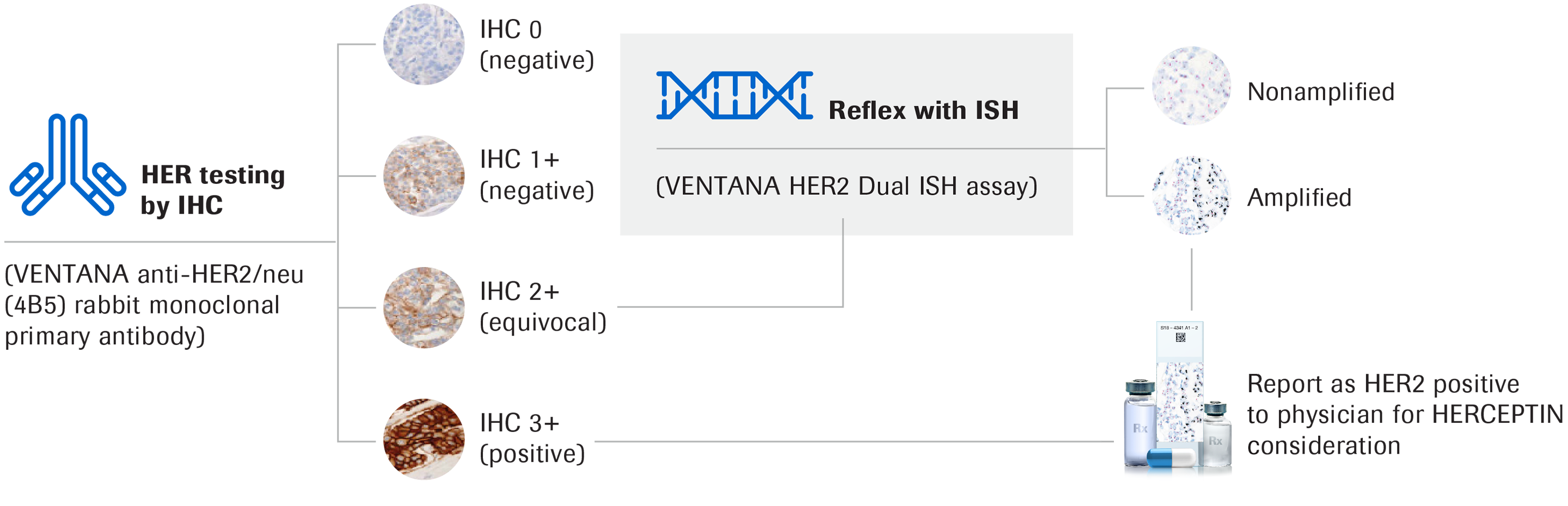 A flowchart of how breast cancer is diagnosed using VENTANA HER2 Dual ISH assays.