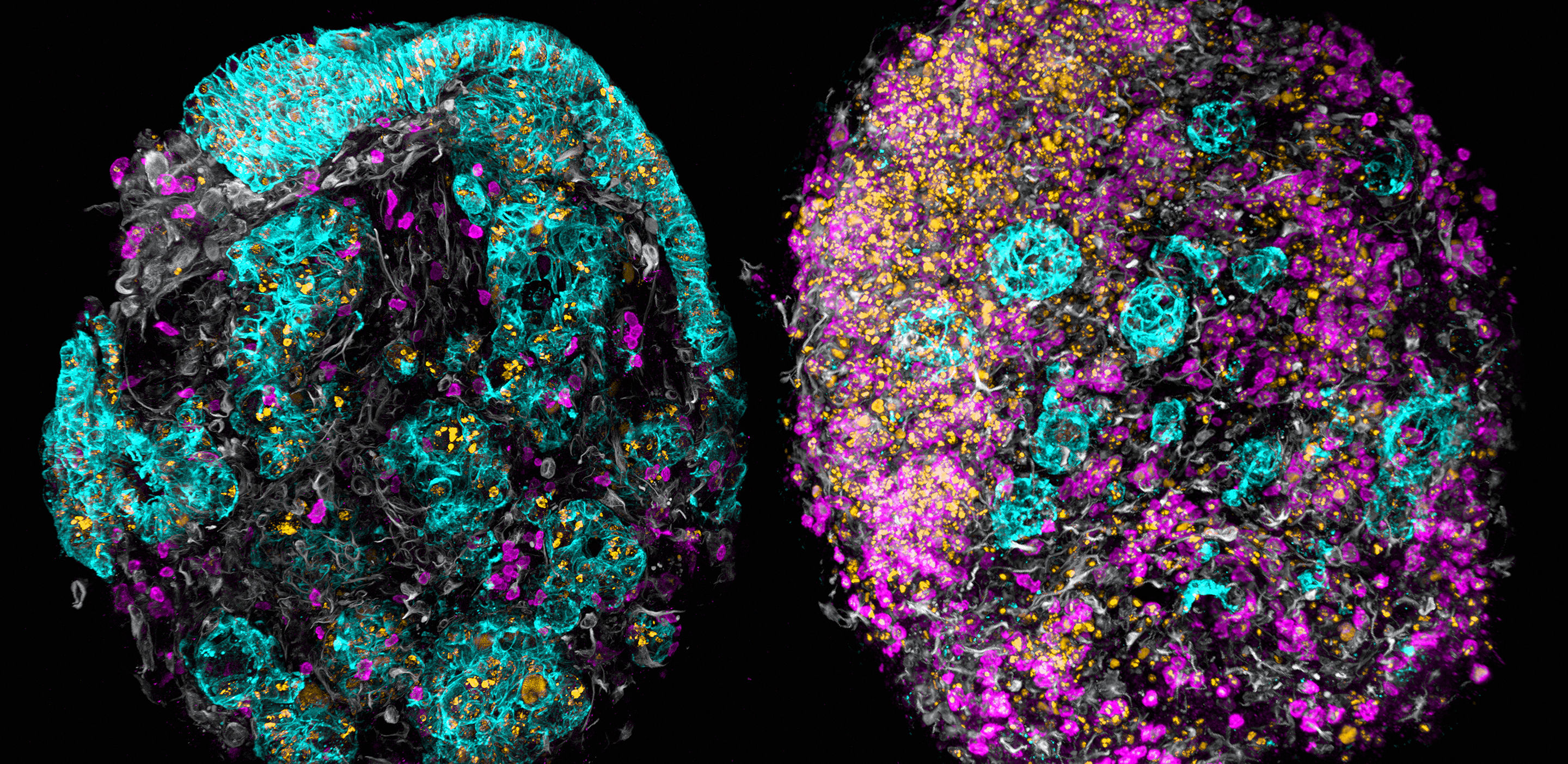 The complex biology of cancer mutations