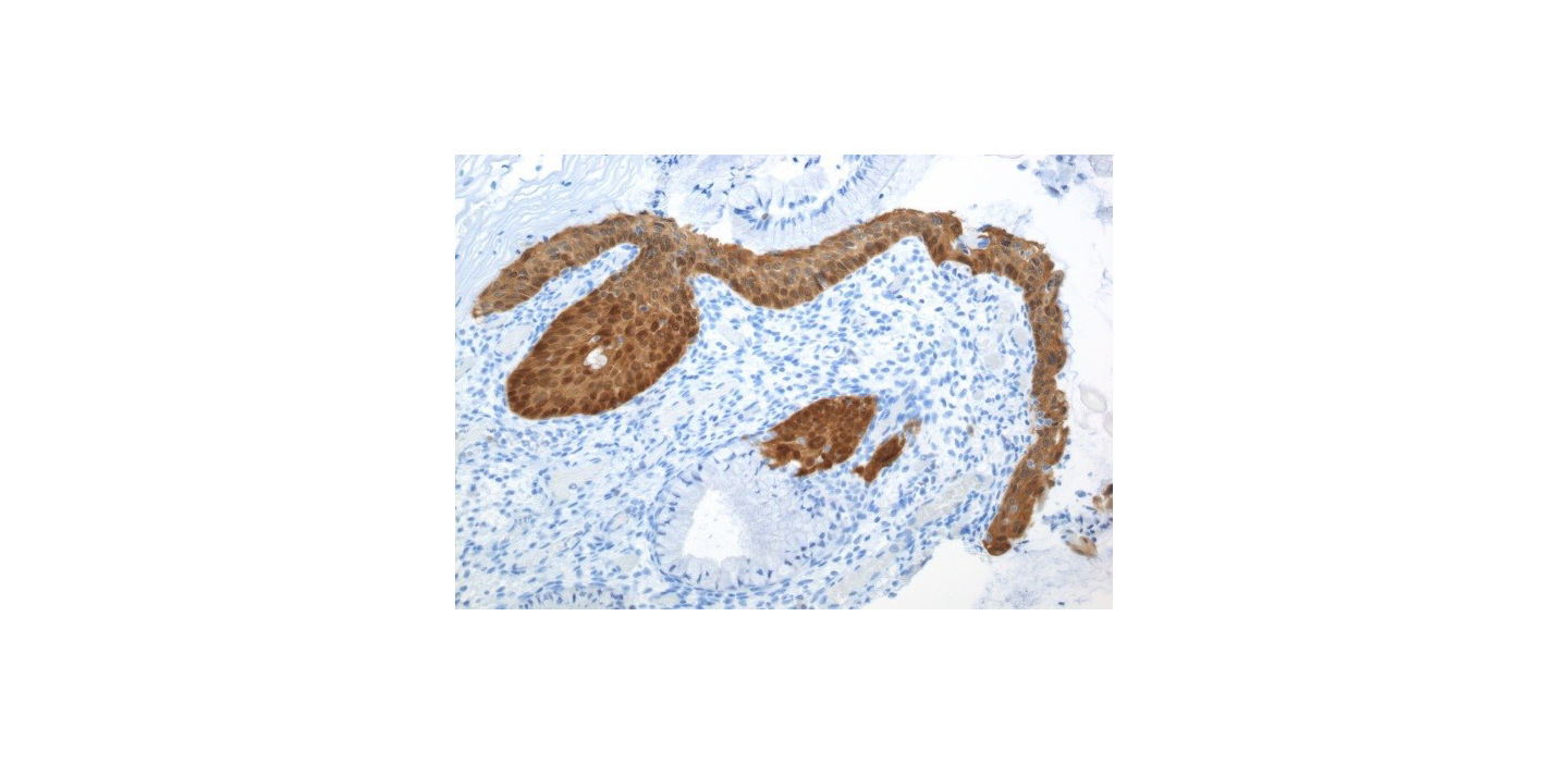 Coloration avec le test CINtec Histology