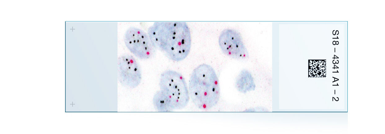 Breast cancer IHC/ISH portfolio