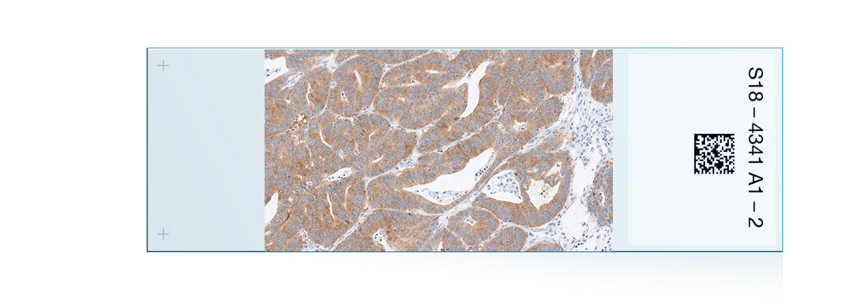 Portfolio IHC colorettale