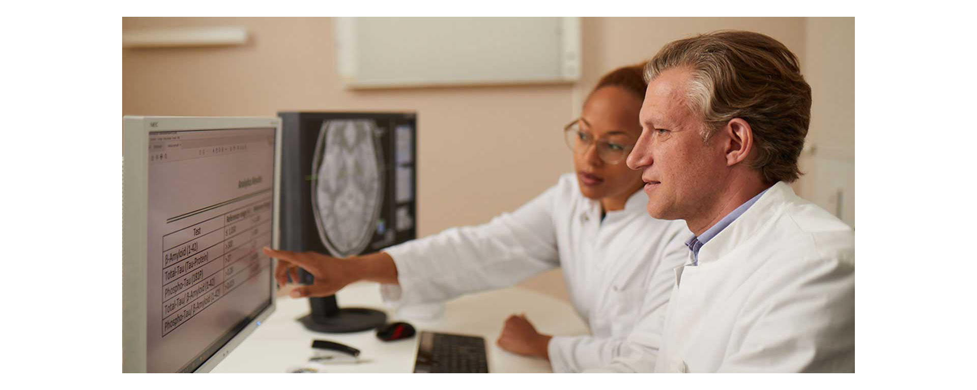 Doctor and lab technicians looking at Alzheimer's Disease assay test results.