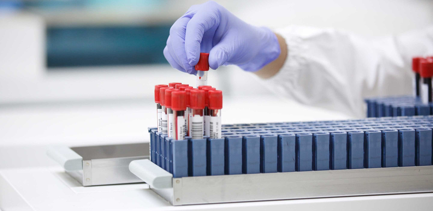 Close up view of person handling blood samples