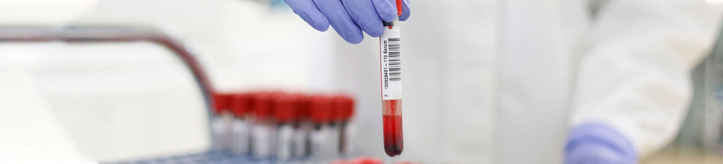 Laboratory employee holding blood sample