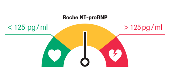 Schéma diagnostiky srdečního selhání 