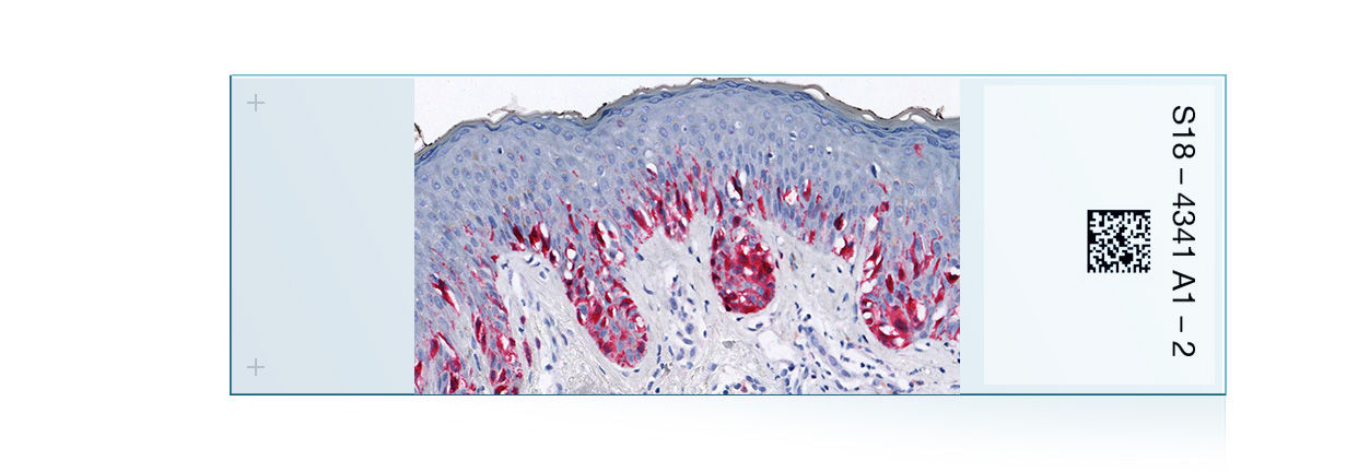 Cartera de productos de IHQ de dermatopatología