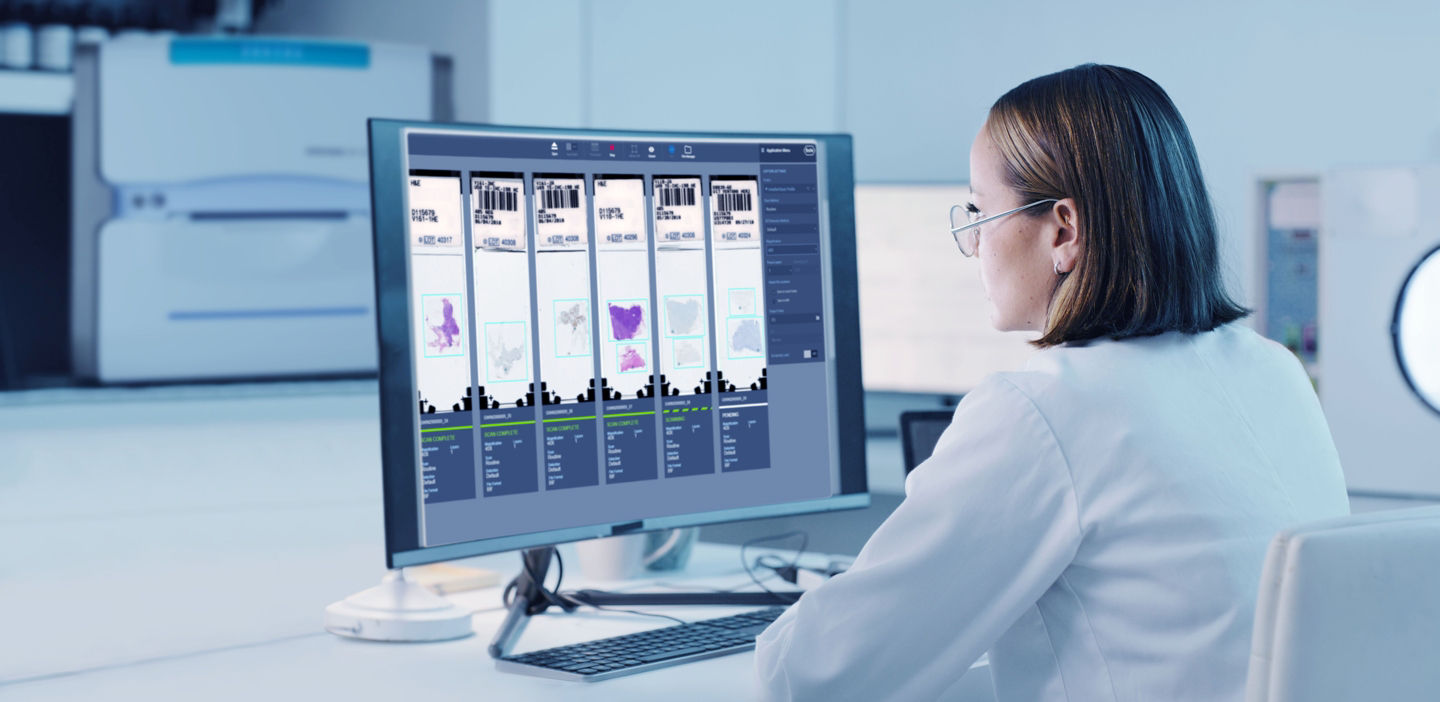 Roche digital pathology total solution