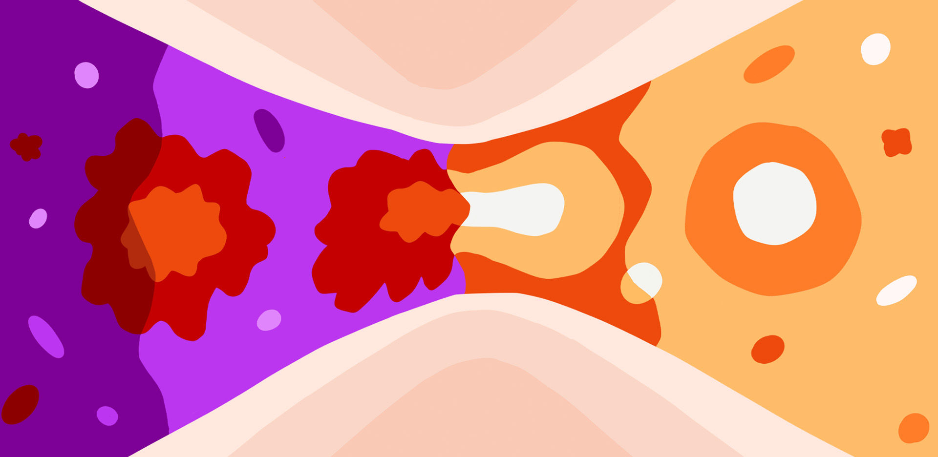 gastrointestinal-infections-gi