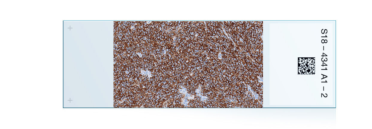 Hematopathology cancer IHC portfolio