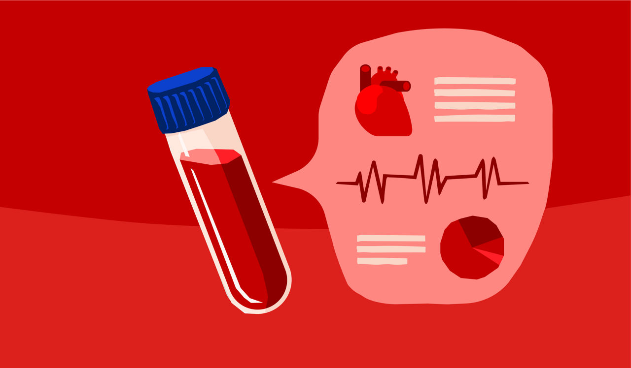 Illustration of a blood sample tube medical report heart and ECG line representing coronary artery disease diagnosis