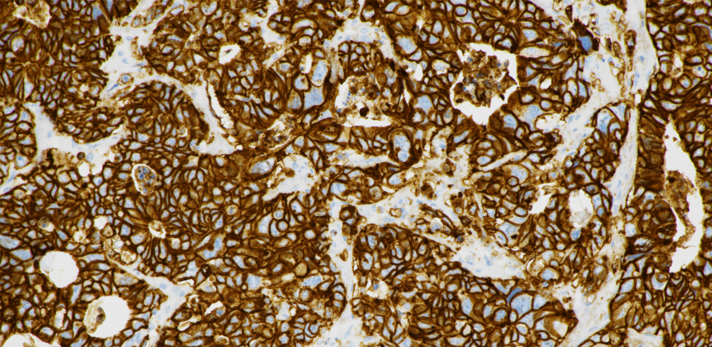 ventana® cldn18 (43-14A) stain image