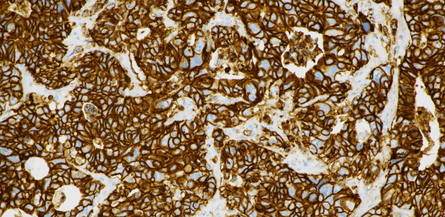 VENTANA CLDN18 (43-14A) RxDx Assay