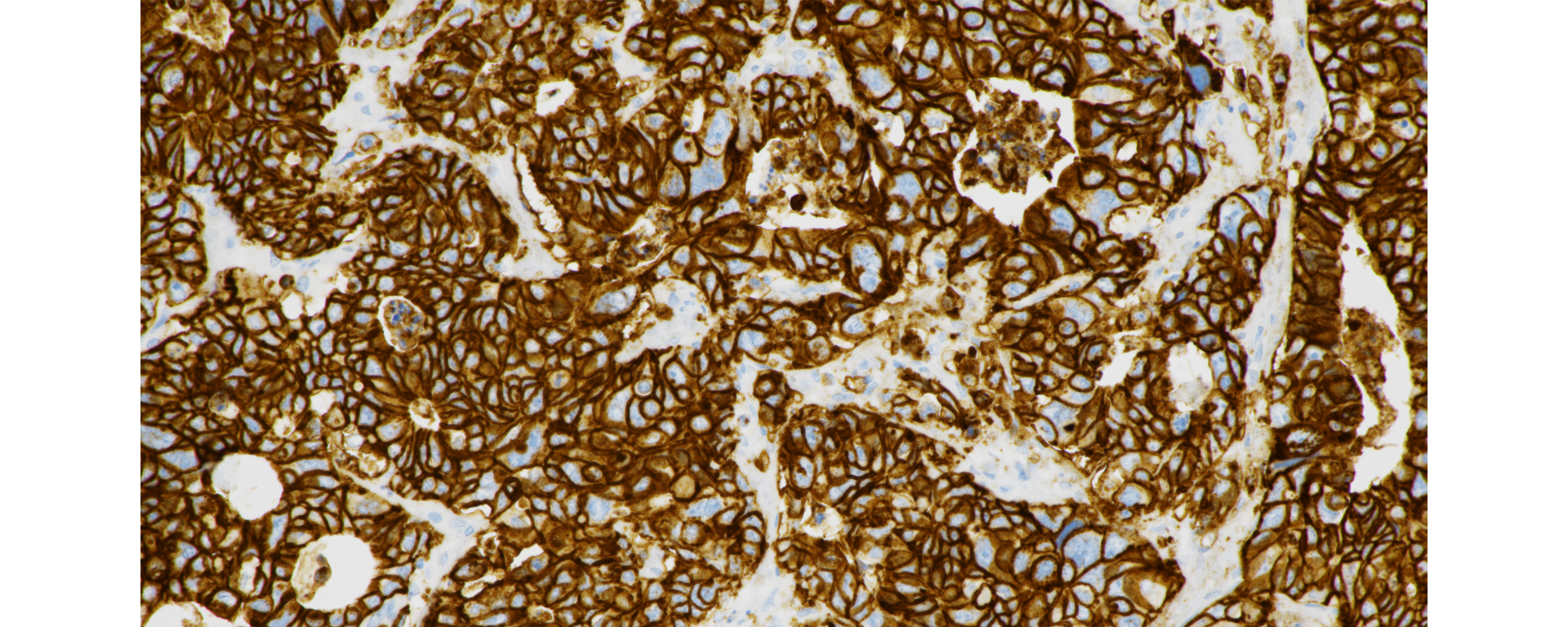 ventana® cldn18 (43-14A) stain image