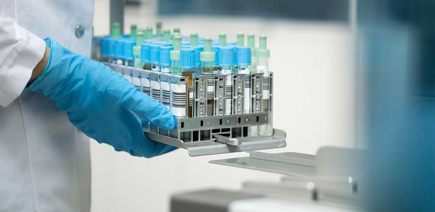 cobas® t 511 coagulation analyzer