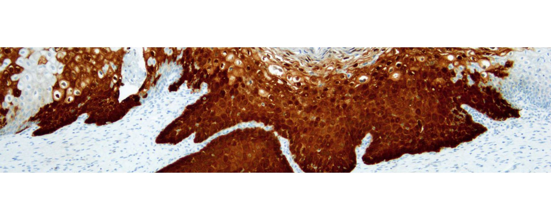 Know now - CINtec Histology