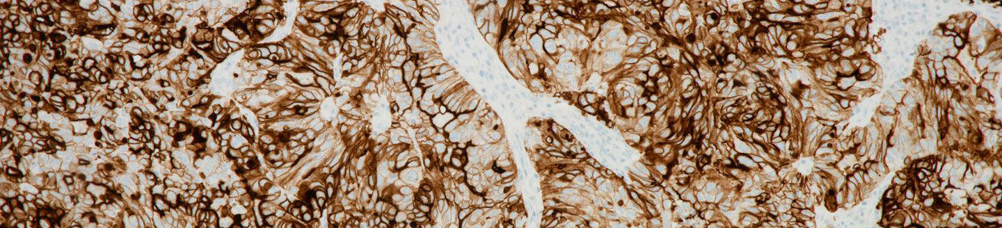 VENTANA FOLR1 (FOLR1-2.1) RxDx Assay Stain