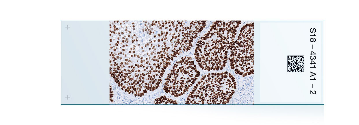 Lung cancer IHC portfolio