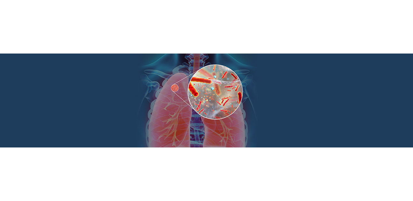 Join Roche at the  World Conference on Lung Health 2024