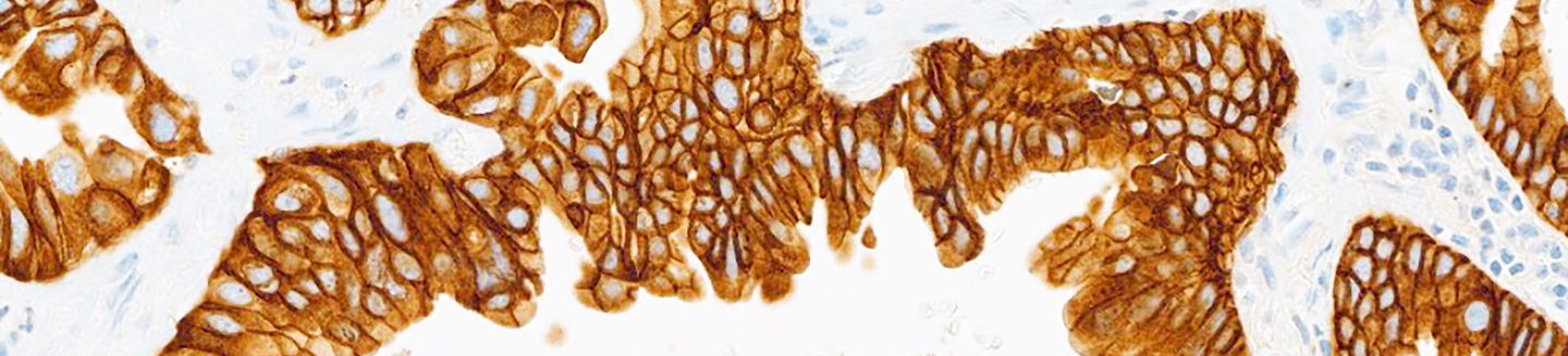 stain of ventana met sp44 assay under microscope
