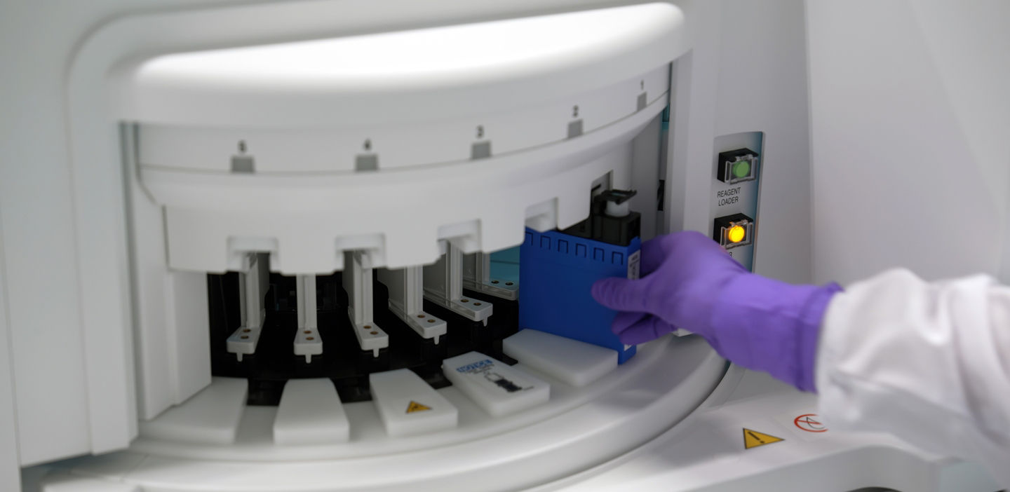 roche tech loads assay in cobas i 601 analyzer mass spec solutoion